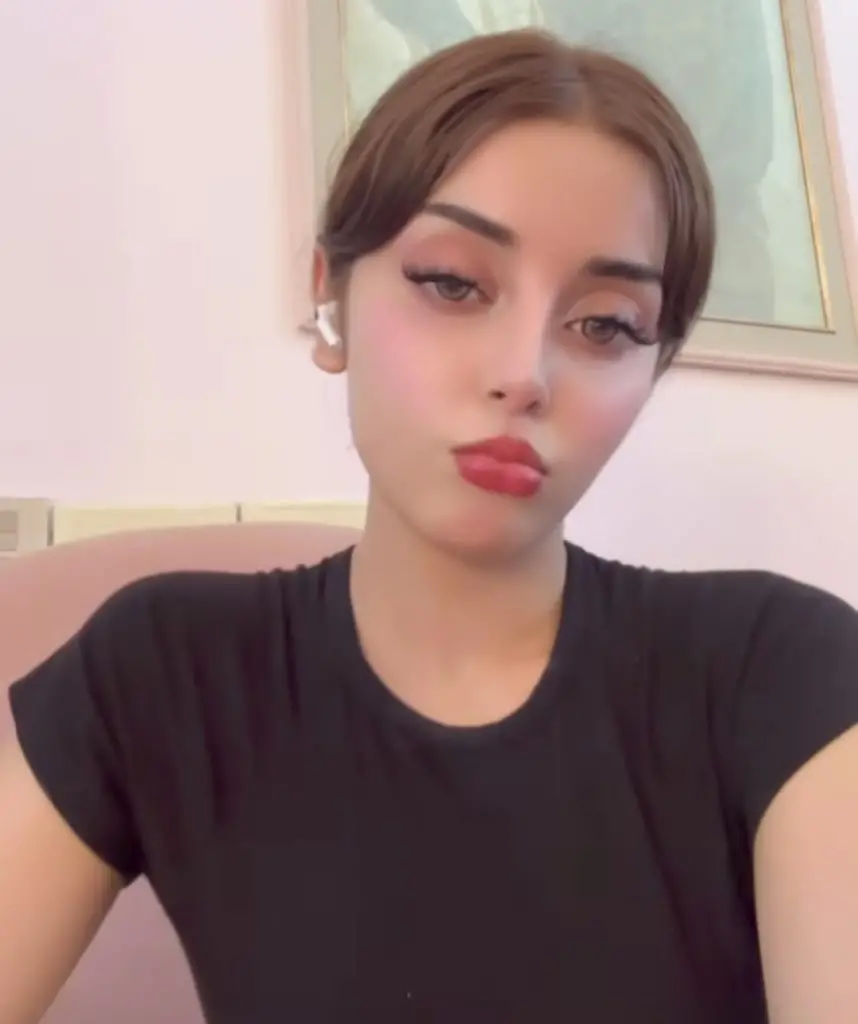 الیز شاہ نے پلاسٹک سرجری کی افواہوں کی تردید کی