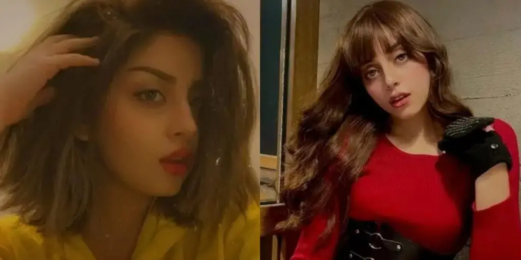 الیز شاہ نے پلاسٹک سرجری کی افواہوں کی تردید کی
