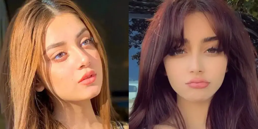 الیز شاہ نے پلاسٹک سرجری کی افواہوں کی تردید کی