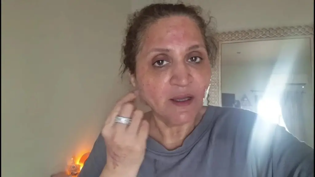 عاصمہ عباس کی جلد کا طریقہ کار غلط ہے