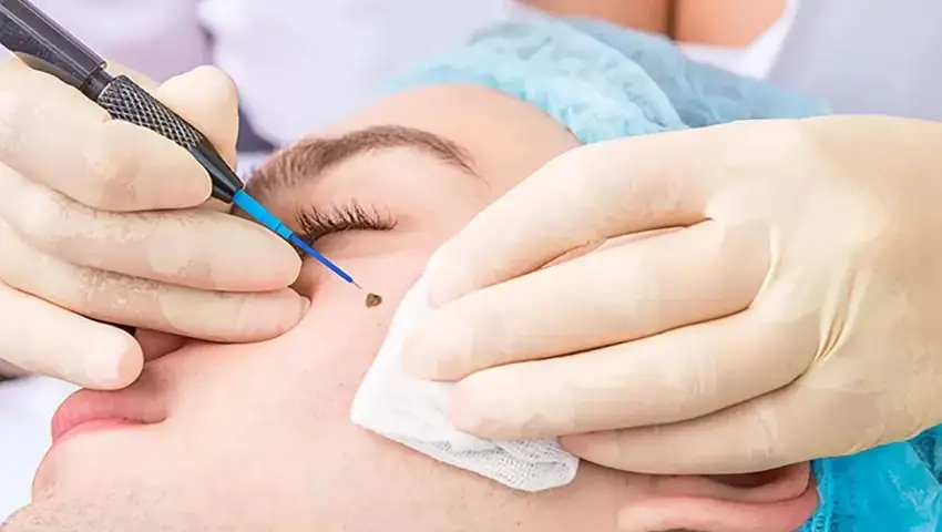 عاصمہ عباس کی جلد کا طریقہ کار غلط ہے