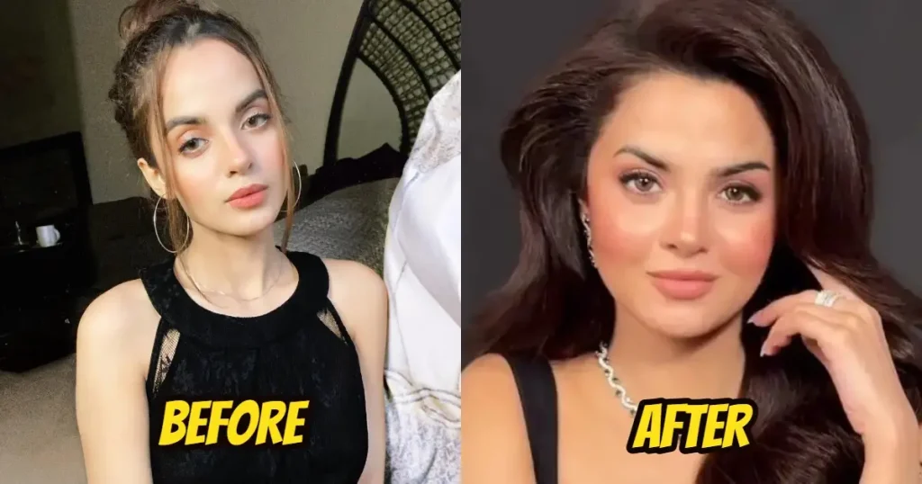 وزن میں اضافے سے ذہنی طور پر متاثر ہونے پر کومل میئر