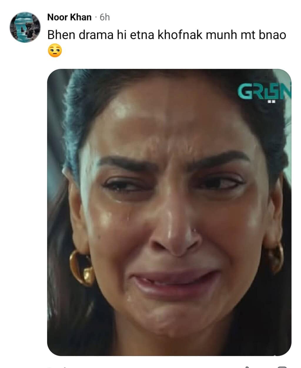 دبئی میں مقیم ڈاکٹر نے پامال میں صبا قمر کے بوٹوکس رونے کا تجزیہ کیا