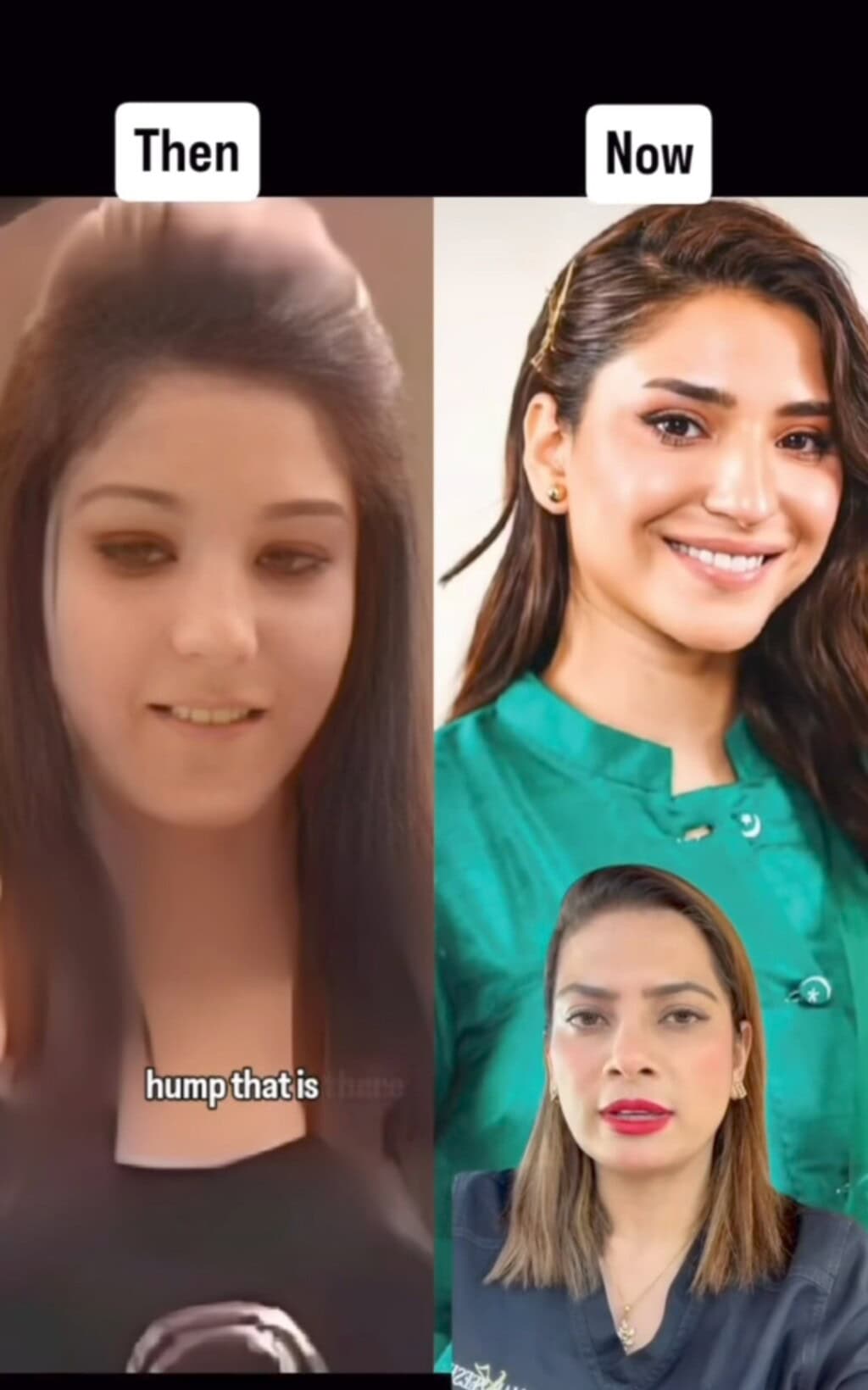 رامشا خان کاسمیٹک سرجریوں نے ڈرمیٹولوجسٹ کے ذریعہ وضاحت کی رامشا خان کاسمیٹک سرجریوں نے ڈرمیٹولوجسٹ کے ذریعہ وضاحت کی