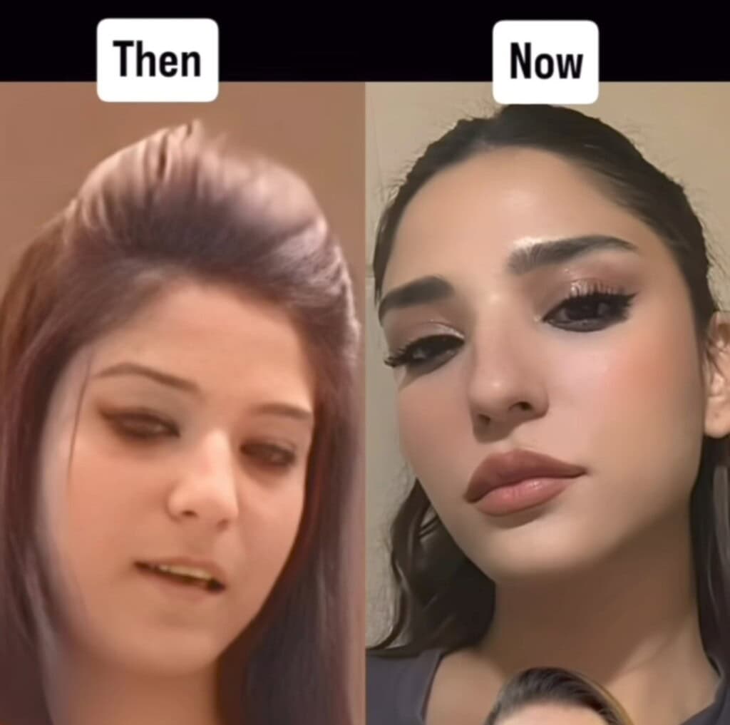 رامشا خان کاسمیٹک سرجریوں نے ڈرمیٹولوجسٹ کے ذریعہ وضاحت کی رامشا خان کاسمیٹک سرجریوں نے ڈرمیٹولوجسٹ کے ذریعہ وضاحت کی