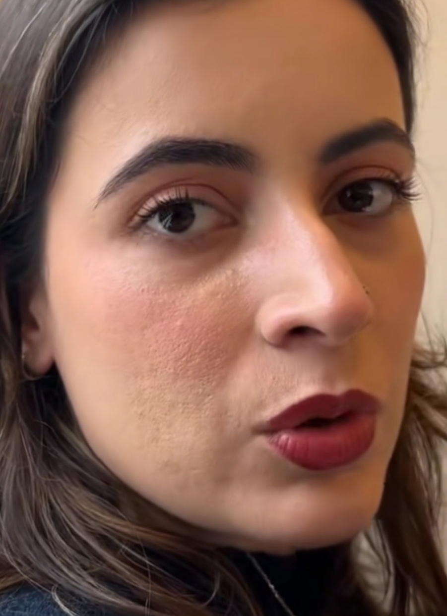 انیا حمزہ علی کی بناوٹ والی جلد سوالات اٹھاتی ہے